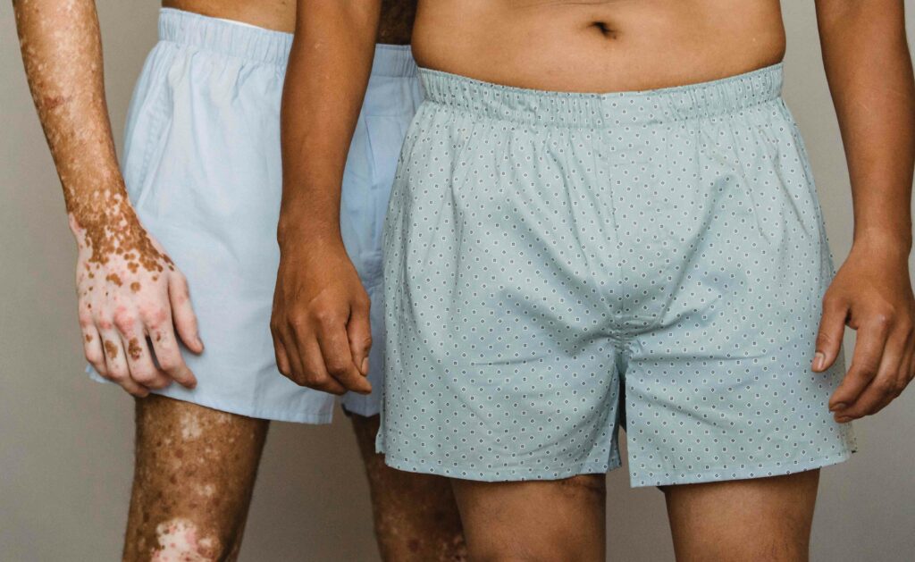 The lower bodies of two men in light-colored boyer shorts.
